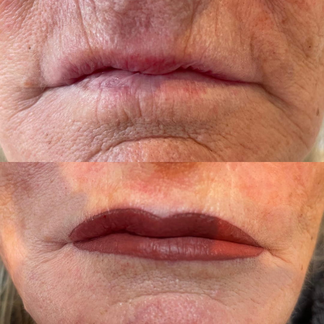 Lippen voor en na foto