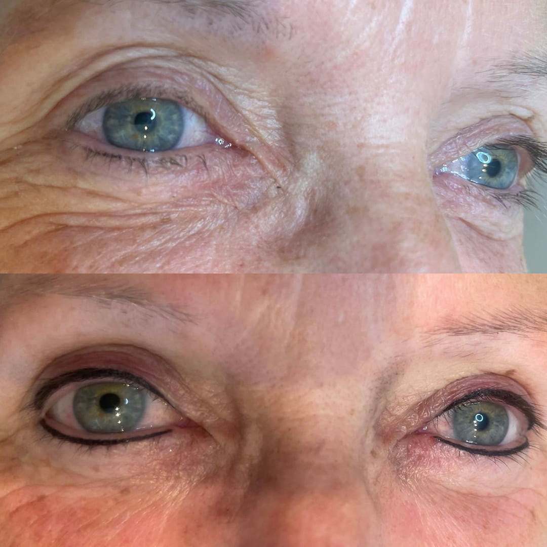 Nathalie Juvyns Permanente Make-Up Eyeliner Voor en na